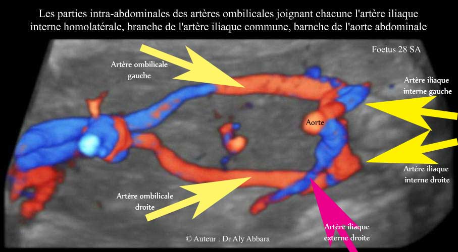 Artères ombilicales : trajet intra-abdominal